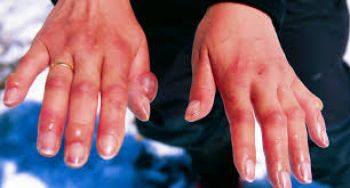 Giải đáp thắc mắc: Khí nitơ có độc không?